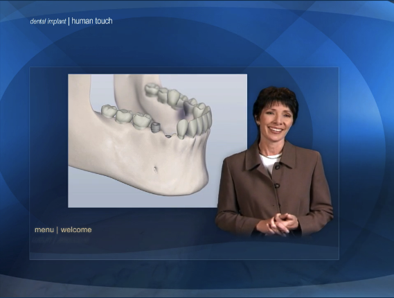 Dental Implants Presentation