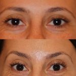 smile gallery photo
