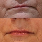 smile gallery photo