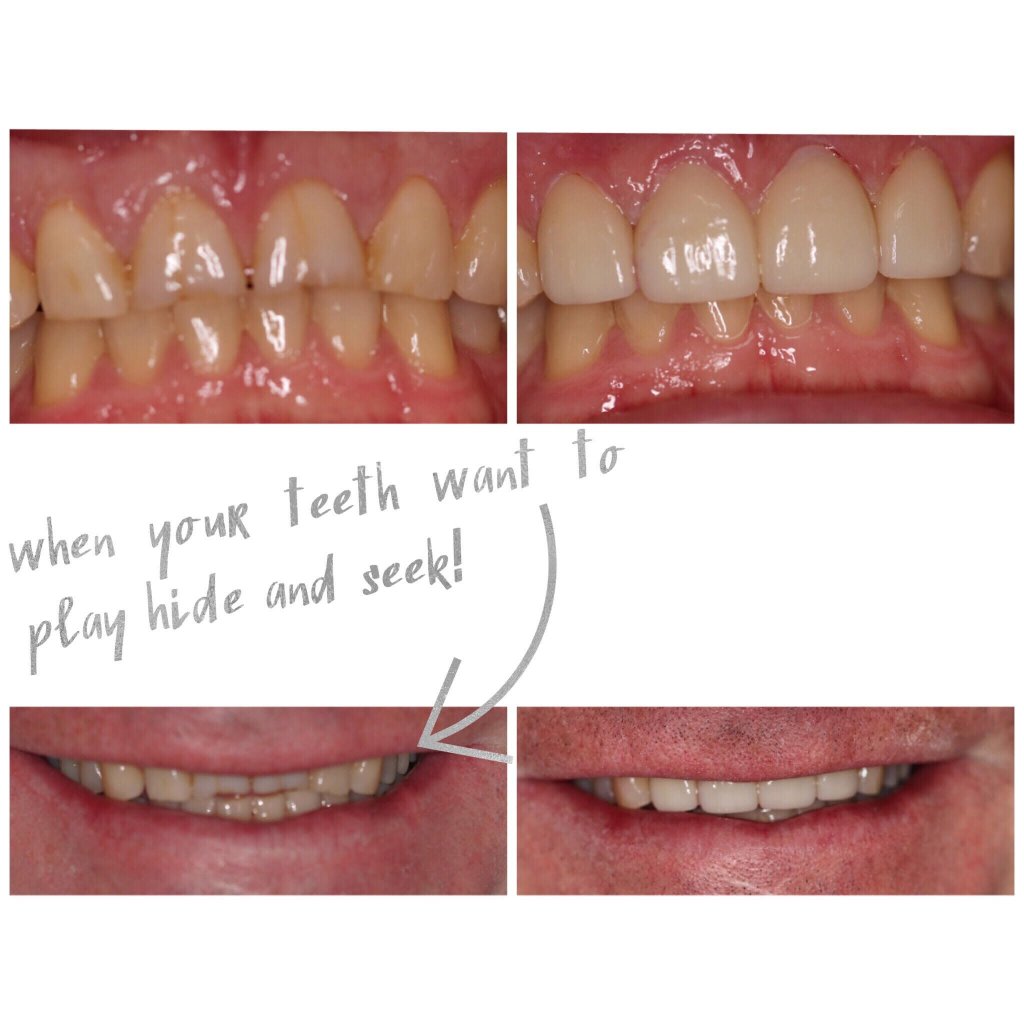 smile gallery photo