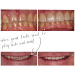 smile gallery photo